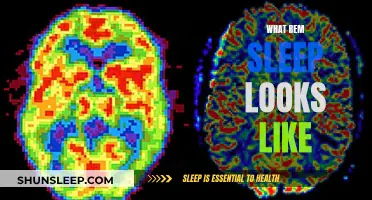 REM Sleep: A Window into the Brain's Activity