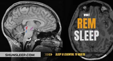 Understanding REM Sleep: The Science Behind Dreaming