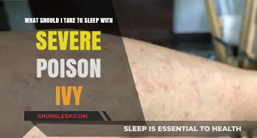 Reliable Sleep with Poison Ivy: Natural Remedies
