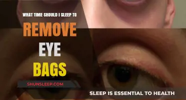 Sleep timing to reduce eye bags