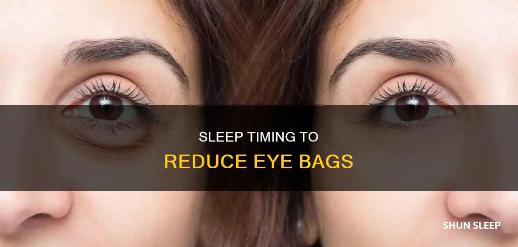 what time should i sleep to remove eye bags