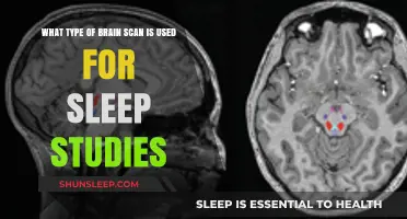 Brain Scans for Sleep: Unlocking the Secrets of Sleep Disorders