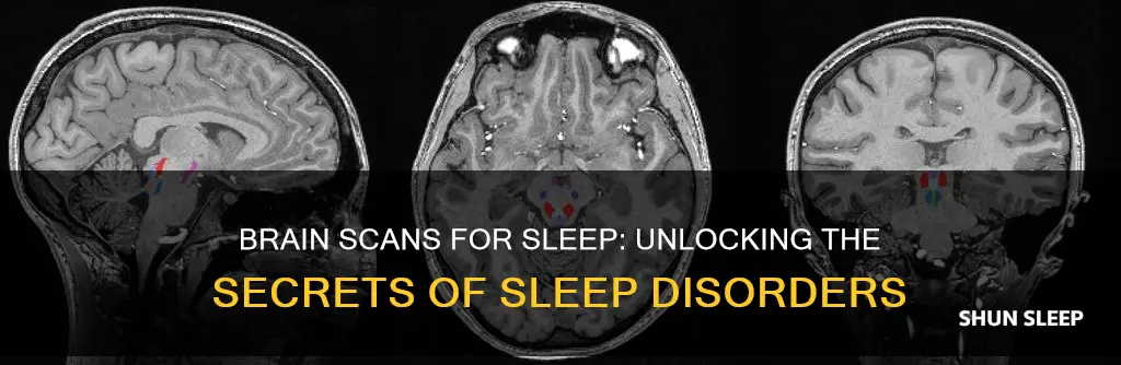 what type of brain scan is used for sleep studies