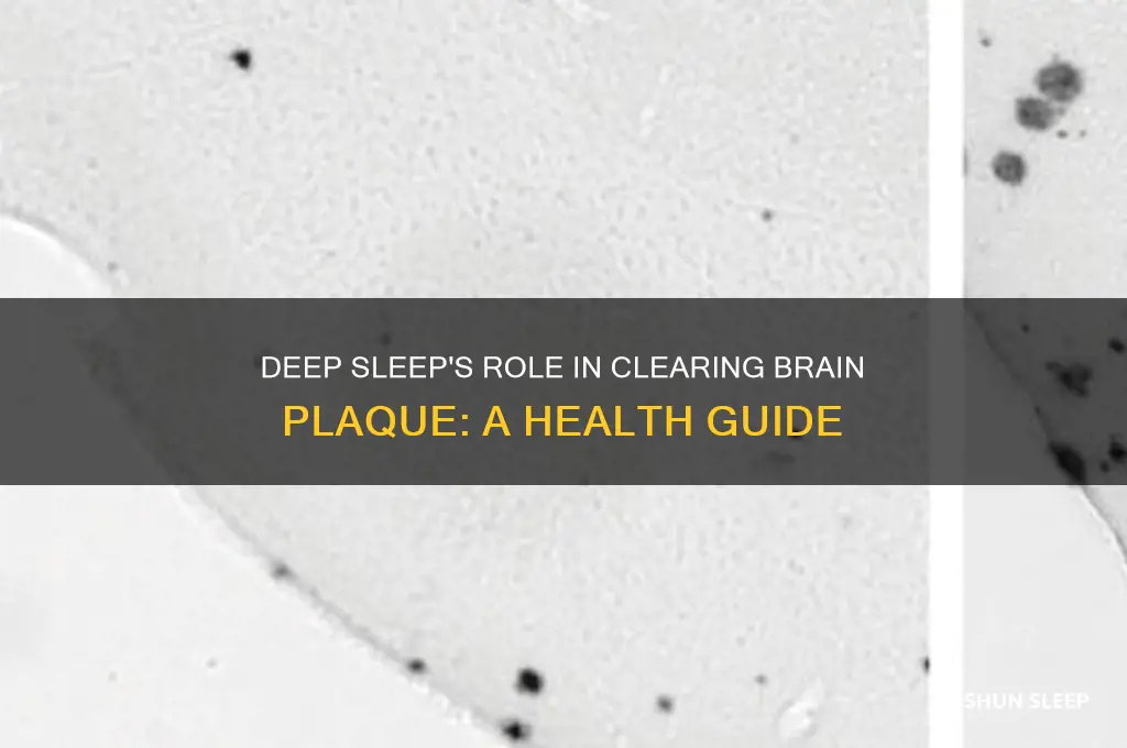 what type of sleep helps brain clean away plaque
