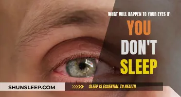 Sleep Deprivation: Eyes Suffer, Here's Why and How