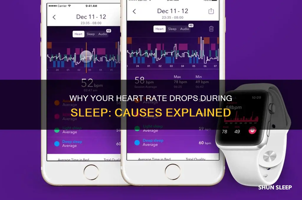 what would cause heart rate while sleeping to get lower