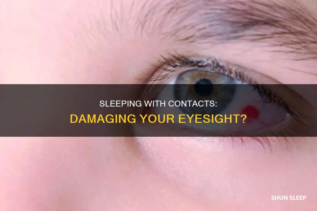 what would happened if you sleep with contacts