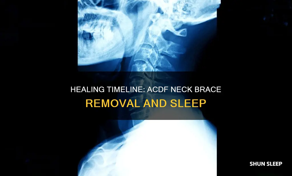 when can i sleep without my acdf neck brace
