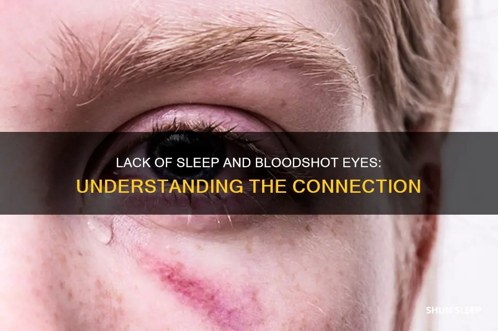 when do your eyes get bloodshot after not sleeping