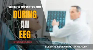 EEG Sleep Studies: When Are They Necessary?