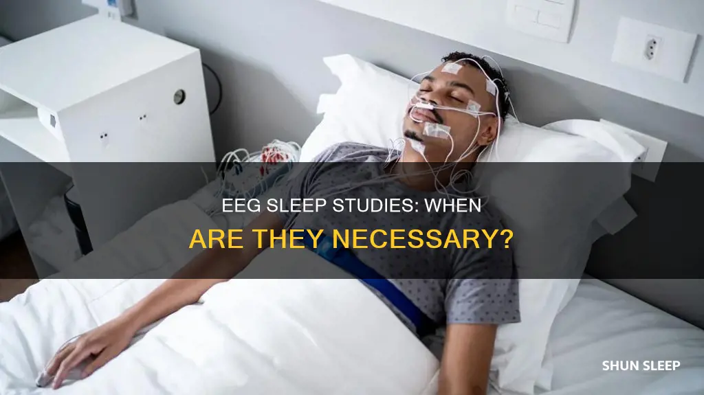 when does a patient need to sleep during an eeg