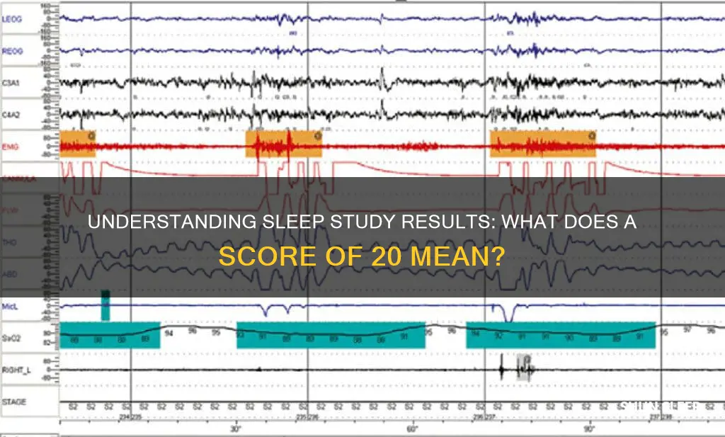 when doing a sleep study what does a 20 mean