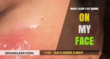 Why Sleep Leaves Marks on My Face: Causes and Solutions