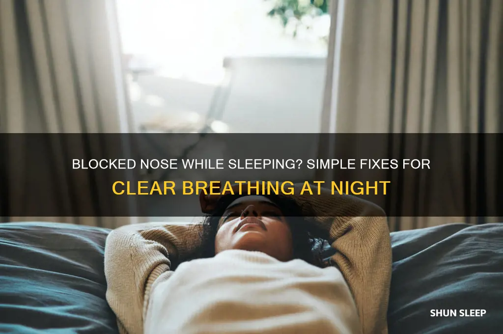 when i sleep my nose gets blocked how to fix