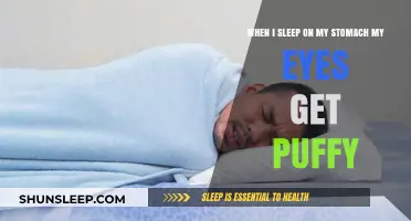 Why Sleeping on Your Stomach Causes Puffy Eyes: Tips to Prevent It