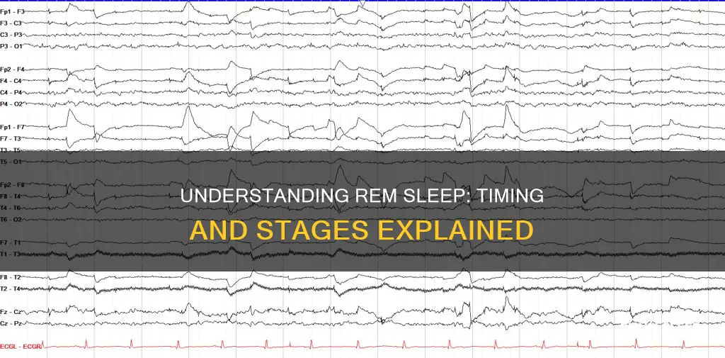 when is rem sleep stage