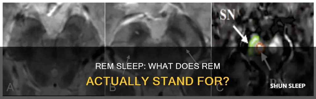 when referring to rem sleep what does rem stand for