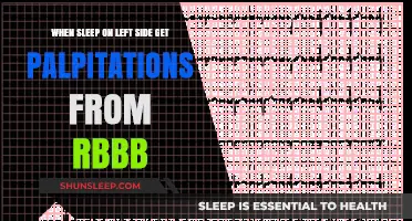 Left-Side Sleep Palpitations: Understanding RBBB and Heart Rhythm Concerns