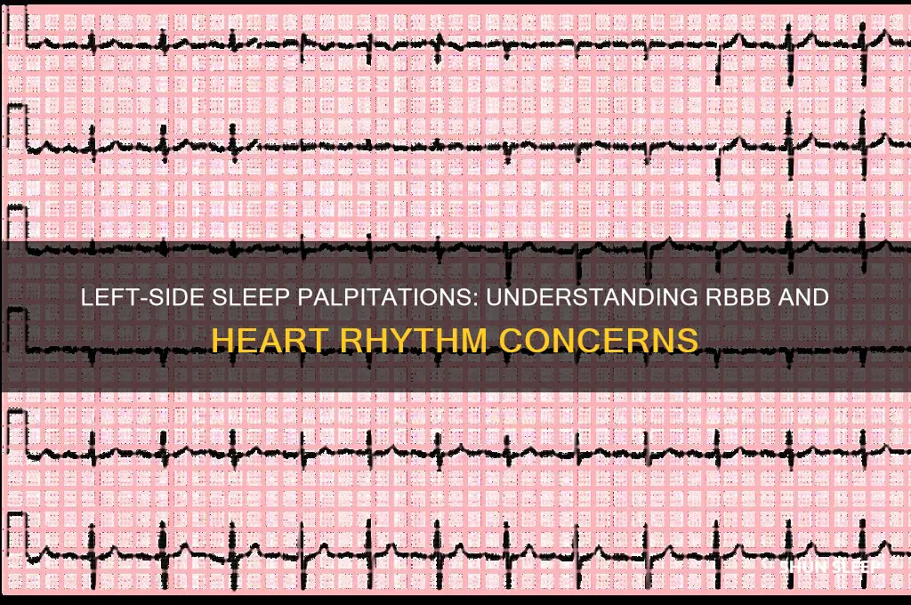 when sleep on left side get palpitations from rbbb