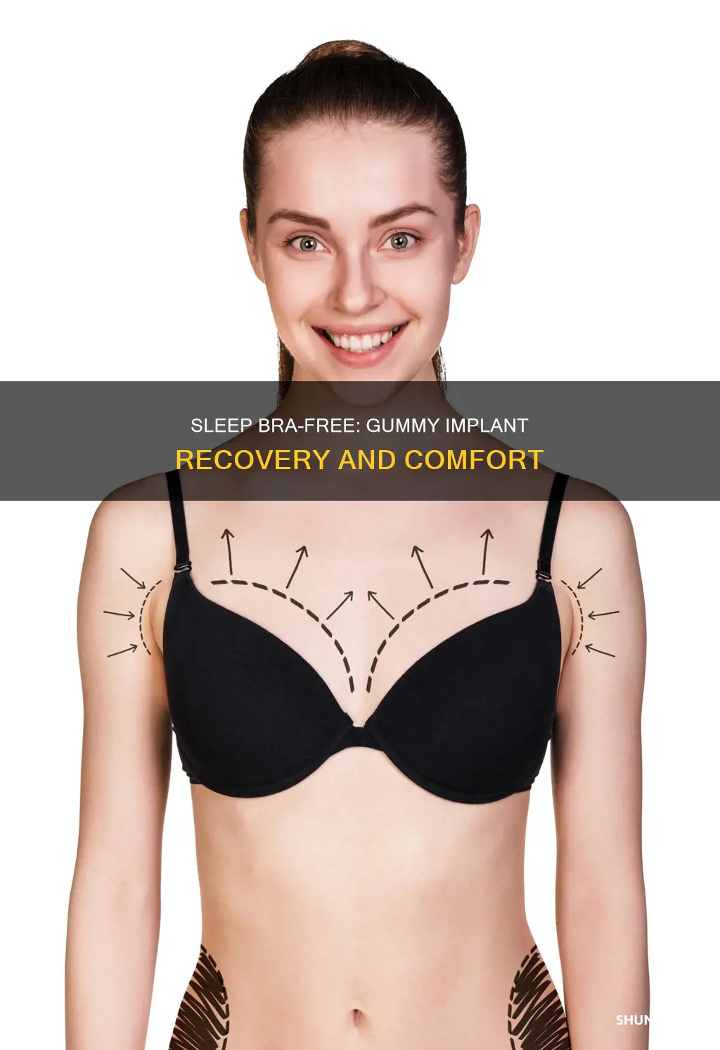 when to sleep without bra after gummy implant