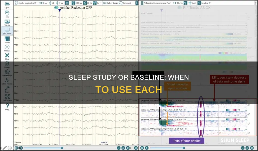 when to use home sleep study vs baseline