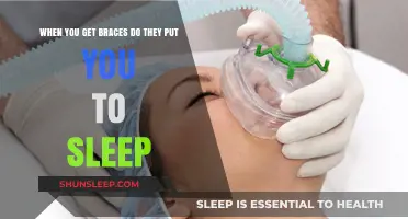 Do You Need Anesthesia When Getting Braces? Facts and Myths