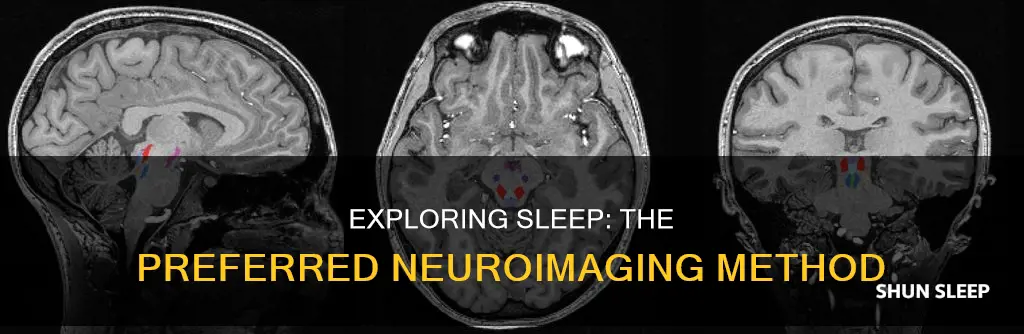 which neuroimaging technique is most commonly used to study sleep