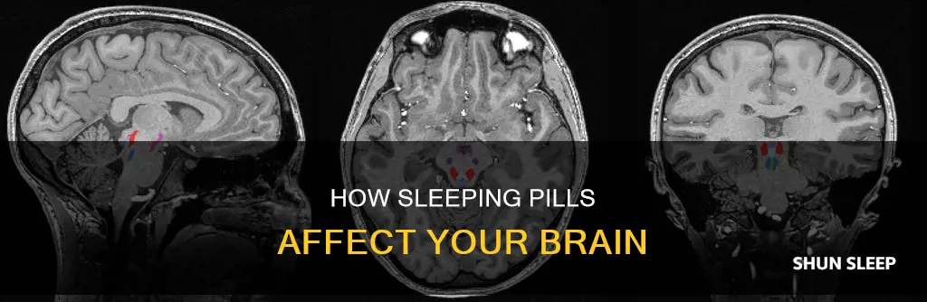 which part of the brain do sleeping pills work on