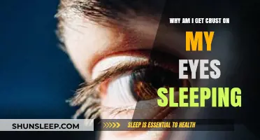 Why Do I Wake Up with Eye Crust? Causes and Solutions