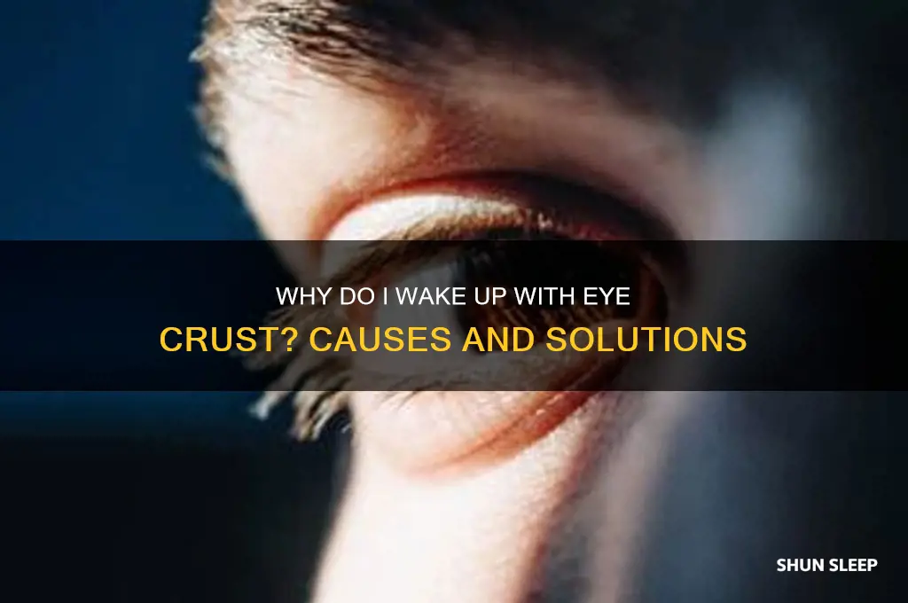 why am i get crust on my eyes sleeping