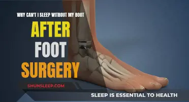 Boot After Foot Surgery: Why It's Necessary for Sleep