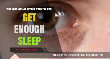Sleep Deprivation and Dark Circles: Understanding the Tired Eye Connection