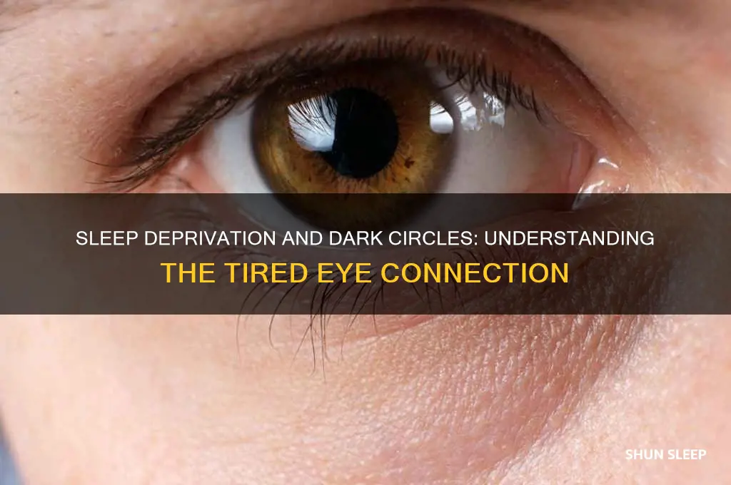 why dark circles appear when you dont get enough sleep