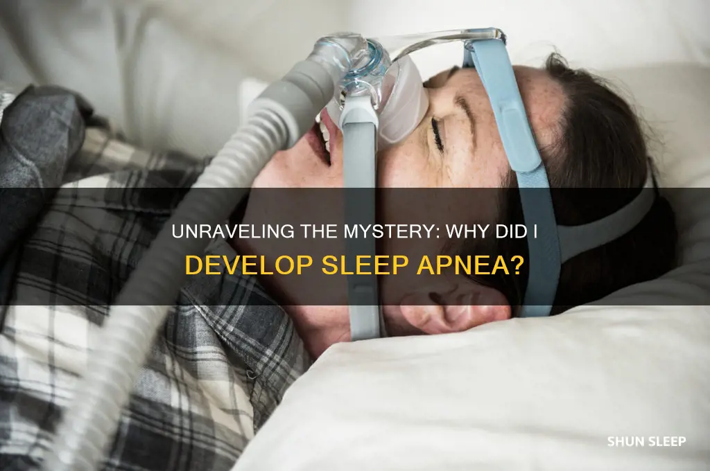 why did i get sleep apnea