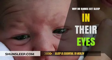 Understanding Why Babies Wake with Sleep in Their Eyes