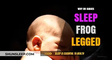 Why Do Babies Sleep Frog-Legged? Exploring the Comfort Position