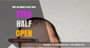 Why Do Babies Sleep with Eyes Half Open? Explained