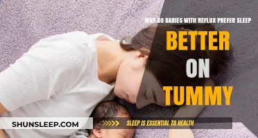 Tummy Sleep: Soothing Reflux in Babies for Better Rest