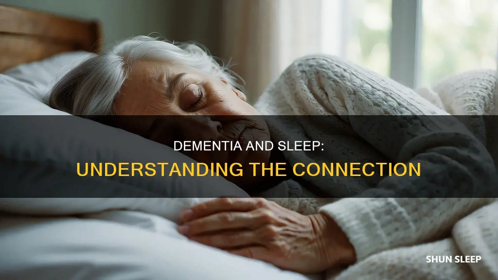 why do dementia patients sleep all day