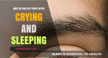 Puffy Eyes Explained: Crying, Sleep, and Fluid Retention Causes
