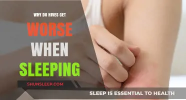 Why Hives Intensify at Night: Unraveling the Sleep-Related Flare-Up Mystery