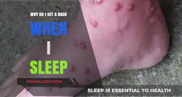 Why Do I Get a Rash When I Sleep? Causes and Solutions