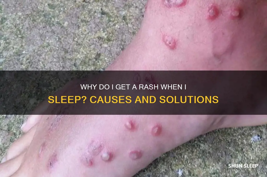 why do i get a rash when i sleep