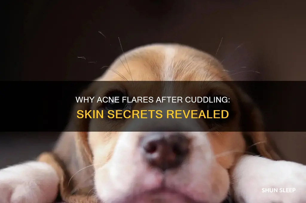 why do i get acne after sleeping with boyfriend