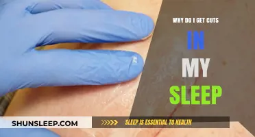 Why Do I Wake Up with Cuts? Exploring Nocturnal Skin Injuries