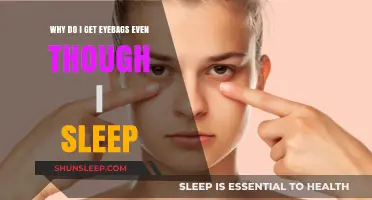 Why Do I Get Eyebags Despite Getting Enough Sleep?