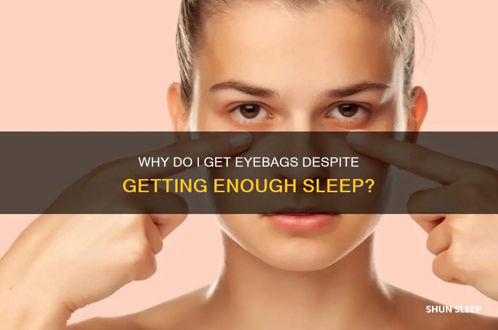 why do i get eyebags even though i sleep