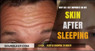 Why Do I Wake Up with Skin Imprints After Sleeping?