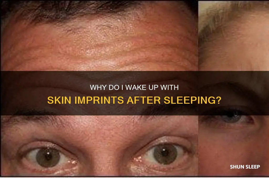 why do i get imprints on my skin after sleeping