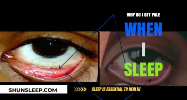 Why Do I Get Pale When I Sleep? Understanding Nocturnal Pallor